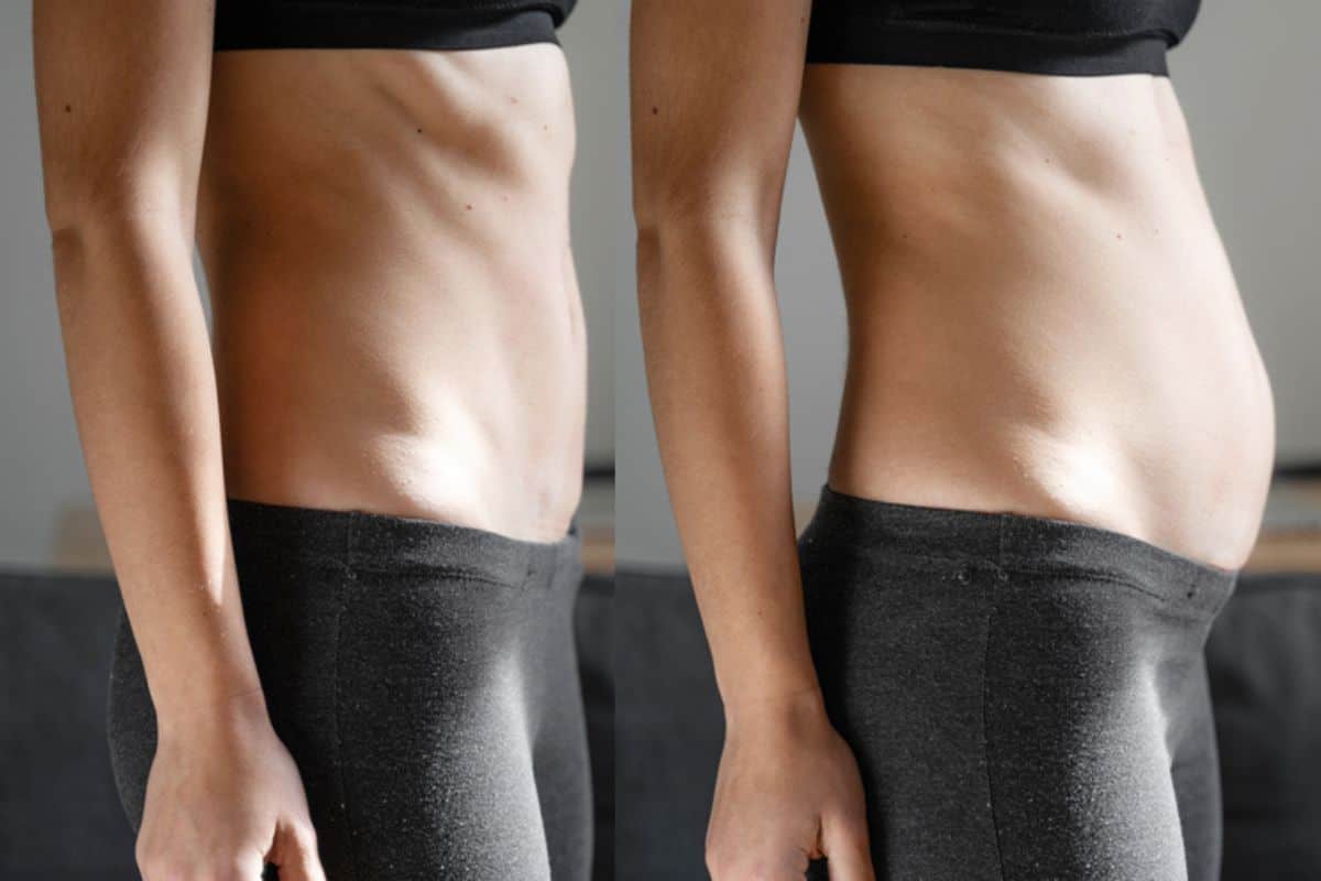 How long does diastasis recti take to improve Greater London (Hounslow)?