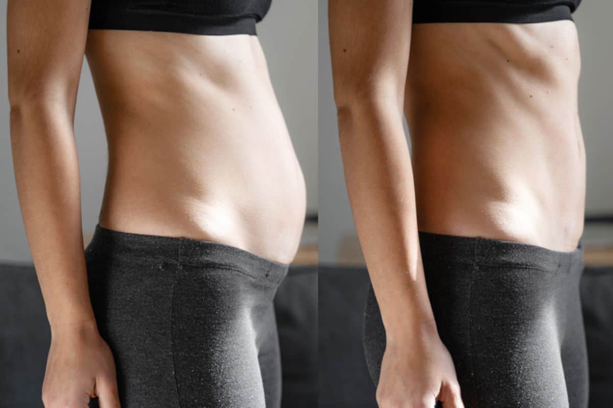 Post-Pregnancy: What Happens to Your Abdominal Muscles After Birth Greater London (Hounslow)