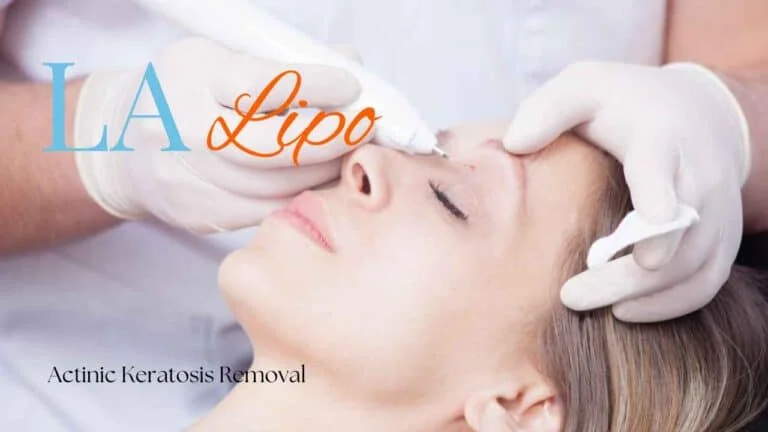Woman receiving Actinic Keratosis Removal Treatment Greater London (Hounslow)