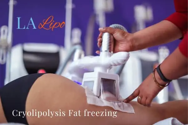 women getting fat freezing Greater London (Hounslow)