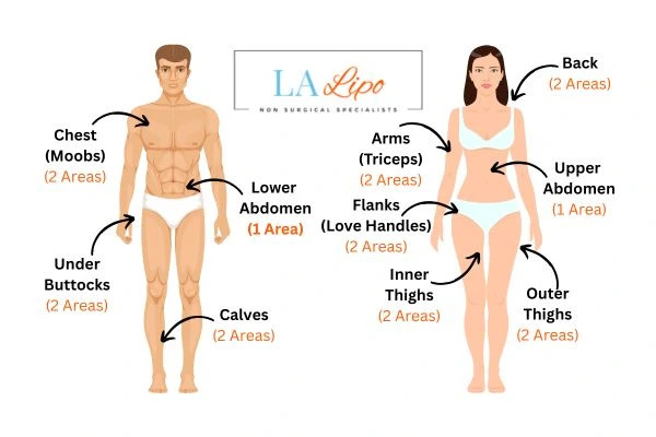 LA LIPO Cryolipolysis Areas Greater London (Hounslow)