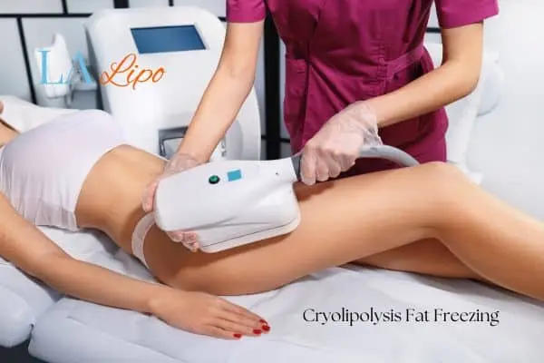 Woman receiving coolsculpting Greater London (Hounslow) treatment on her thighs
