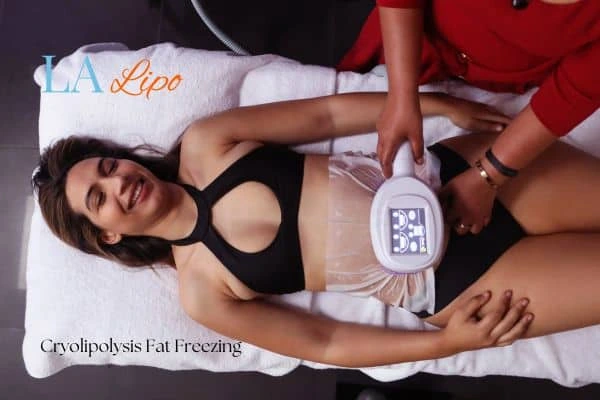 woman getting cryolipolysis Greater London (Hounslow)