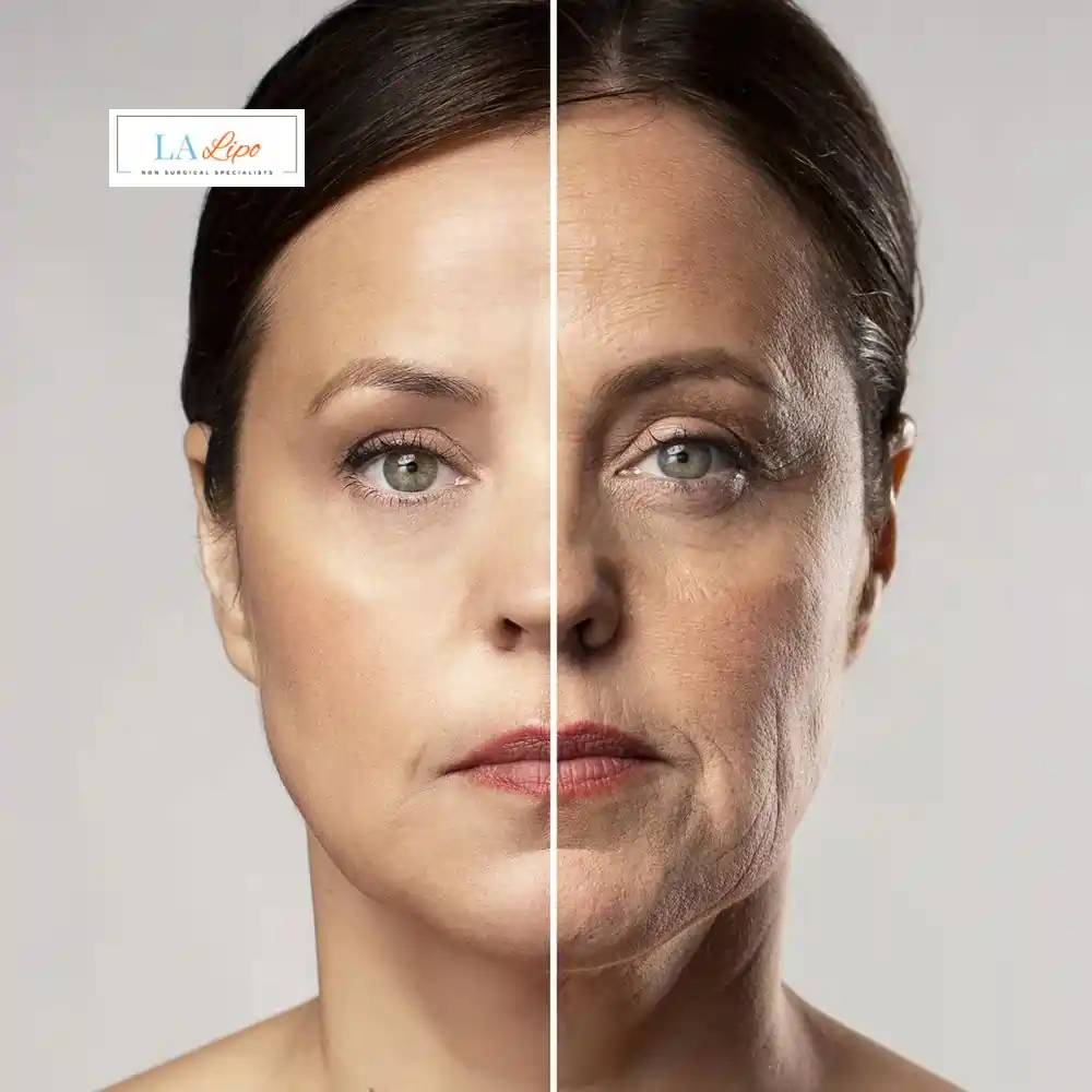 How Can You Tell If Non-Surgical Skin Tightening Is Right for You Greater London (Hounslow)?