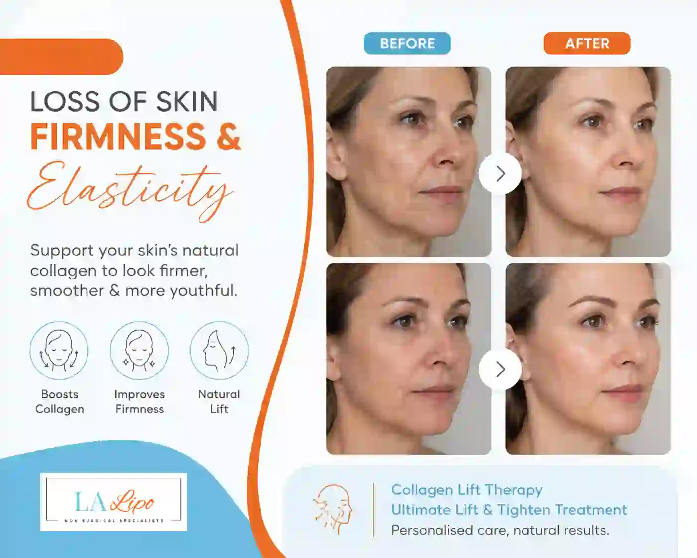 Sign #7: Loss of Skin Firmness and Elasticity Greater London (Hounslow)